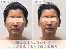 セリーナ 伊賀上野店(CELINA)の雰囲気（小顔矯正でたるみ/シワ改善！[小顔/肩こり/骨盤矯正/脱毛/毛穴]）