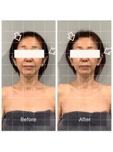 カドル(cuddle)/PARAFUSE.式ドライヘッドスパ