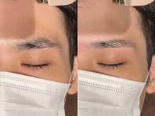 アイクイック 日暮里 西日暮里駅前店(Ai Quick)/アイブロウワックス脱毛