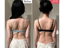 ラビス(RAVIS)/背中の見た目もガラッと変わる♪