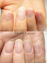 マリーロール 淀屋橋本店(Marie Laure)/自爪育成/深爪矯正/ネイルケア