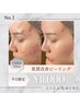 人気No.1【平日限定◆本気の肌質改善】剥離なしピーリング7種 