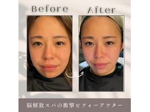 ソア(Soa)の雰囲気（ぱっちり目、お顔リフトアップ、脳疲労回復の脳解放スパ！）