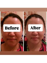 マンマ ジュンナ 小顔 矯正