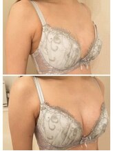 美人バスト 浦和店/【バストアップ★育乳】症例