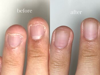 フェミニンネイル(Feminine Nail)/