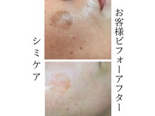 ミーラブ 鹿児島(miilove)の雰囲気（肌質改善なら当店へ。オーダーメイドエステで通う度美肌力アップ）