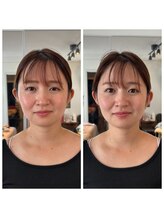 サワコウボウ セラピー(SAWAKOBO therapy)/産後姿勢小顔矯正