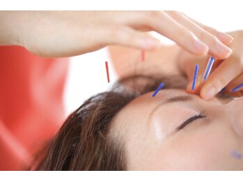 つばさ整骨院 鍼灸院 新潟女池院の写真/国家資格者が多数在籍!ベテランスタッフが、一人ひとりの年齢や体質によるお悩みに丁寧に寄り添います!