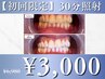 【初回限定¥3,000】セルフホワイトニング30分¥6,980→¥3,000