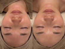 リレアボーテ(RILEA BEAUTE)の雰囲気（オープン記念モニター募集！詳細はブログへ）