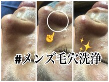 エステルーム クリスタル/メンズ毛穴洗浄