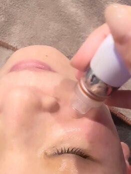 チアリス(chiariss)の写真/速攻性を求める方に！洗浄・導入・保湿・美白を一度に行える【チアリス式ハイドラ毛穴洗浄】