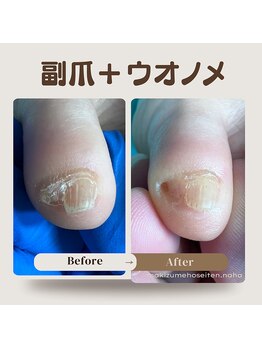 巻き爪補正店 那覇店/