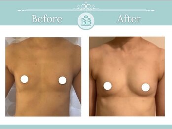 美人バスト 掛川店/【バストアップ/育乳静岡/浜松】