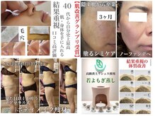 デアマリス