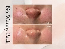 ビシア(Bicia)/松ヤニパック