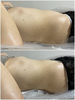 美 プラス(美 Plus)/【レモンボトルの変化】