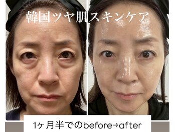 ヴィディトゥ(vidyto)/ICD【韓国式ツヤ肌スキンケア】