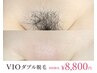 【人気No.1】水着を着る前に！WAX＋光脱毛でツルツル長持ち♪VIOダブル脱毛