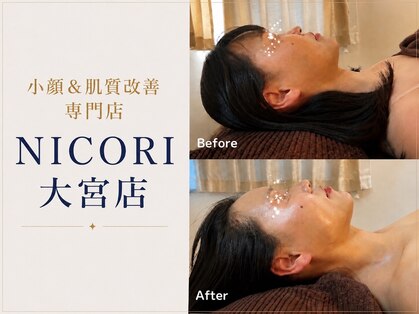 ニコリ 大宮(NICORI)の写真