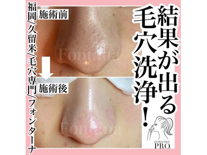 フォンターナ(Fontana)の写真