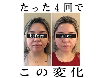 キュープ 富山店(Qpu)の写真