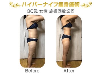 モアリフレッシュ(MoreRefresh)/