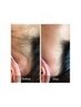 【脱毛】意外と見られてる！うなじWAX脱毛   ¥2200
