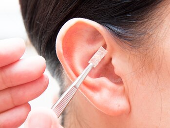 ベルネージュ(Belle Neige)/耳ツボ施術