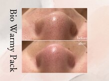 ビシア(Bicia)/松ヤニパック