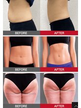 トータルビューティーサロン バンブー(Bamboo)/30分寝てるだけで腹筋50000回！