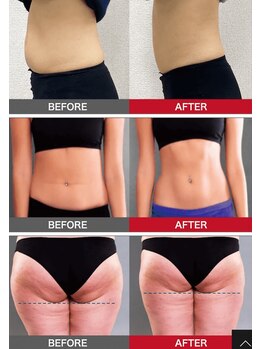 トータルビューティーサロン バンブー(Bamboo)/30分寝てるだけで腹筋50000回！