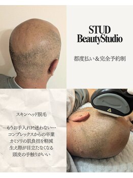 スタッド(STUD)の写真/毎日の面倒なお手入れから卒業!脱毛でワンランク上の清潔感あふれる自分へ。あなたの理想を叶えます♪