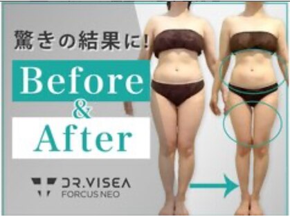 フィールファイン(feel fine)の写真