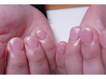 プチリリィ(Petit Lily)/補強の為にジェルネイルを