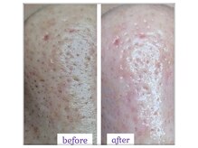 ラディア(Radia)/