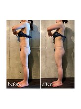 ボーレーヴ 表参道店(beaureve)/施術効果写真（before after）