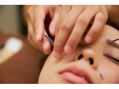 クラール鍼灸整骨院 盛岡肴町院の写真