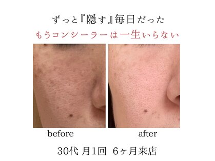 キラリ(kirari)の写真