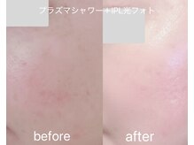 ティアラ 錦糸町(TIARA)/