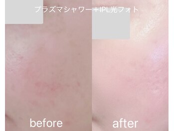 ティアラ 錦糸町(TIARA)/