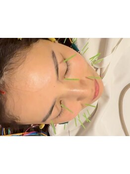 小顔になりたい