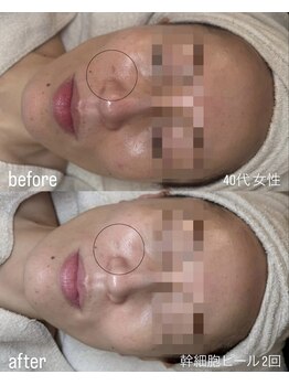 フロル(FLOR)/FLOR 【根本改善専門店】