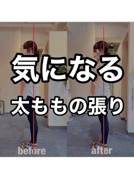 カワル整体 上通り院/太ももの張りが気になる人
