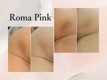 ビシア(Bicia)/Roma　Pink☆★
