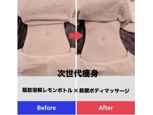 マスカレード(Masquerade)の雰囲気（最新痩身【レモンボトル筋膜ボディ】¥9,800）