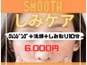 しみケア10分ショート 6000円《平日500円off》