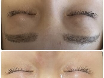 ラヴィ(Ravi)/目元ケア