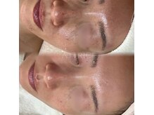 アトリーチェ(ATTRICE)の雰囲気（サロンケア×ホームケアの両方から美肌づくりをサポートします！）